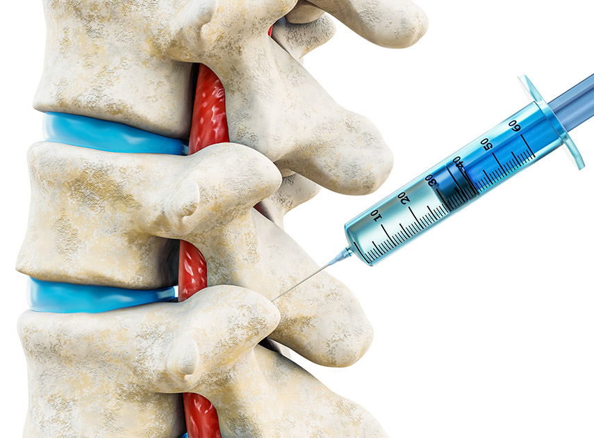 Close-up-of-spine-and-syringe