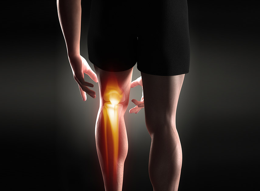 Digital-illustration-of-a-knee-in-pain,-needing-knee-arthroscopy
