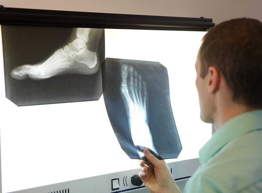 Male-physician-examining-foot-x-ray-scan