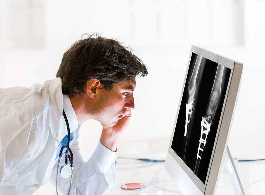 Male-physician-examining-x-ray-scan-of-trauma-and-fracture-fixation-on-computer-monitor