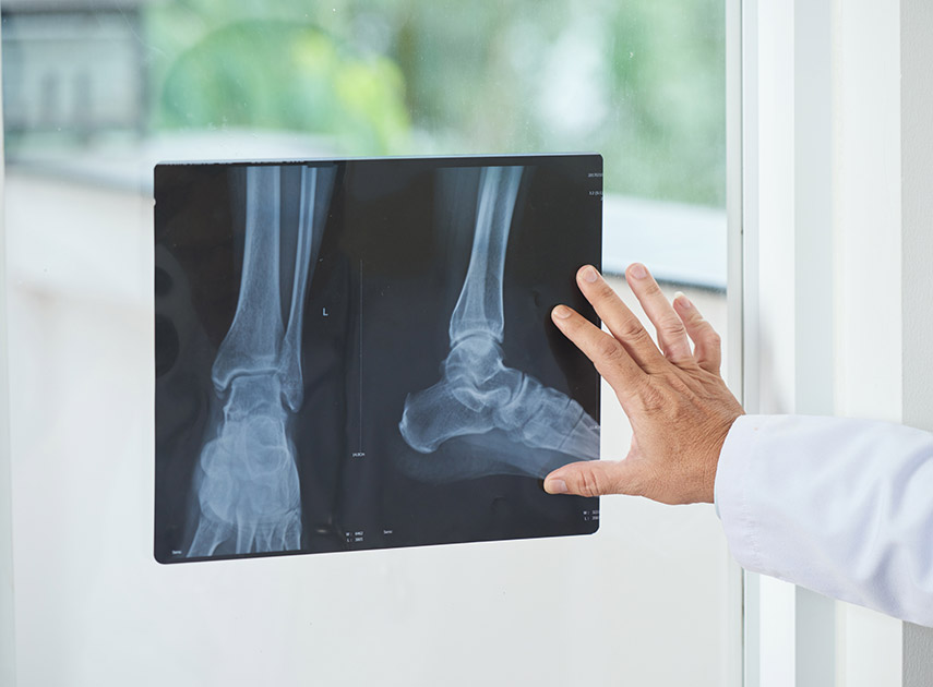 Physician-examining-x-ray-picture-of-ankles