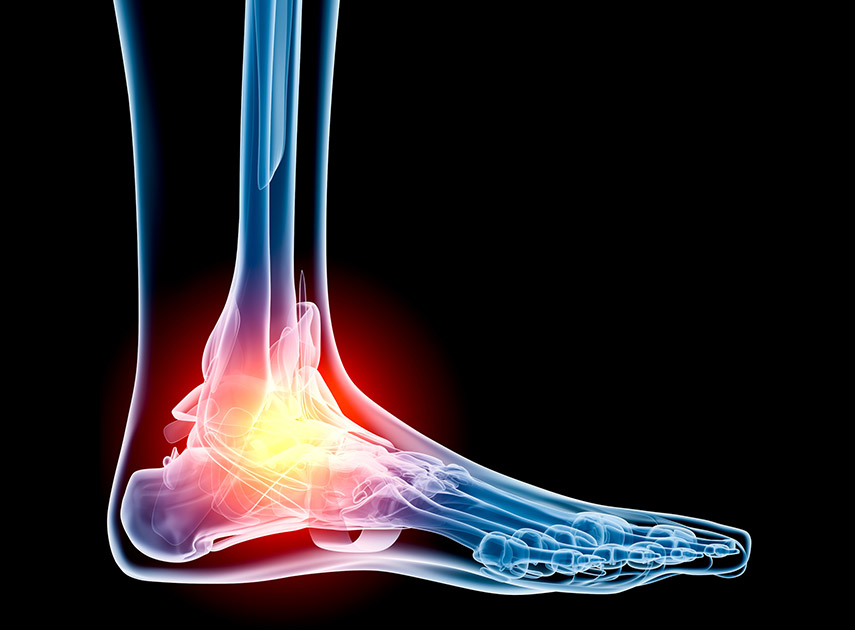 X-ray-scan-of-ankle-in-pain