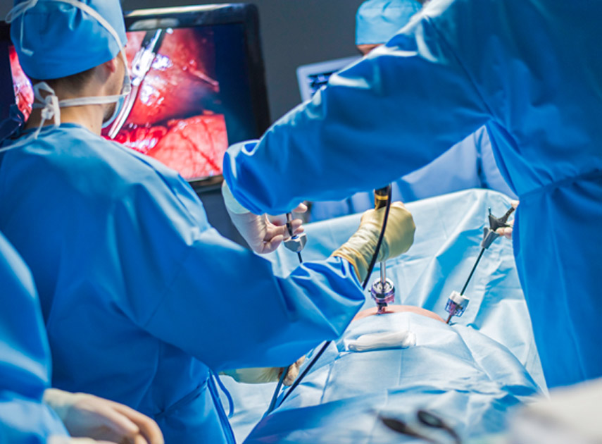 Team-of-surgeons-performing-laparoscopic-gastric-sleeve-surgery