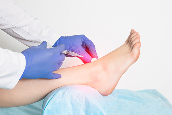 Ankle-Joint-Injection